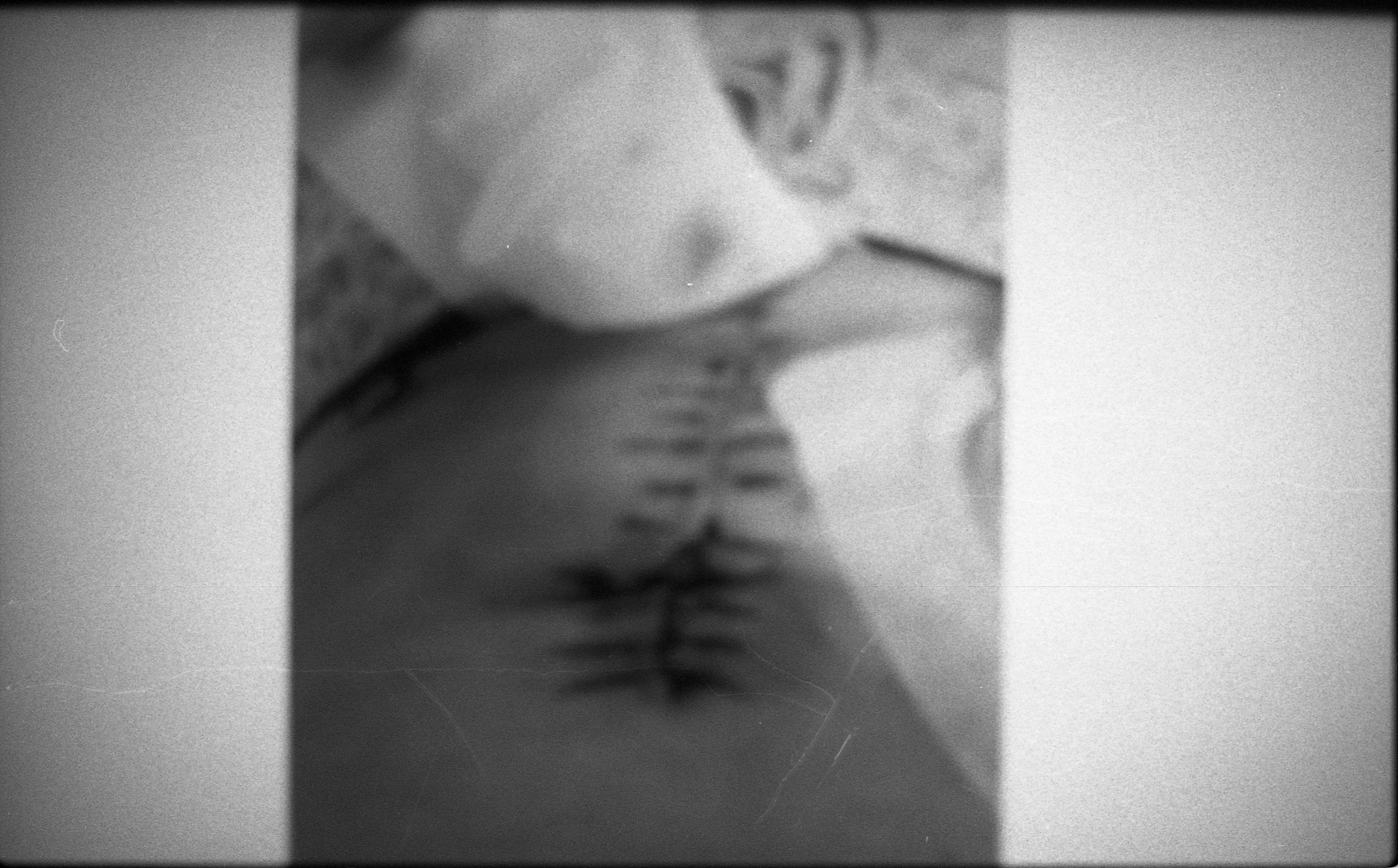 Anja - Medical detail 1