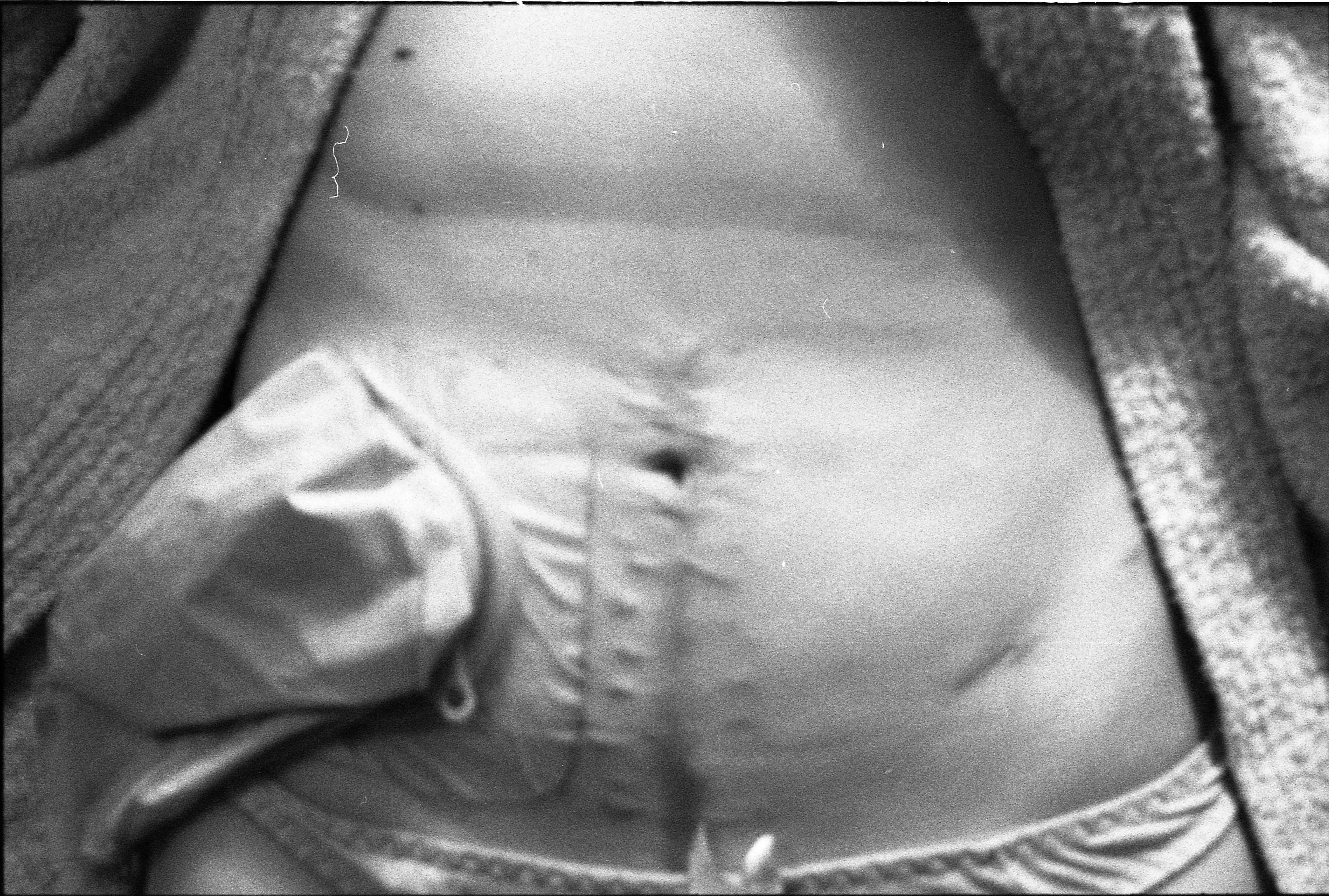 Anja - Medical detail 2